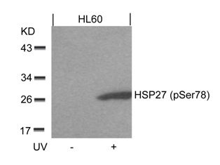 HSPB1 Antibody