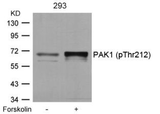 PAK1 Antibody