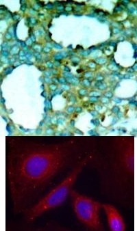 PAK1 Antibody