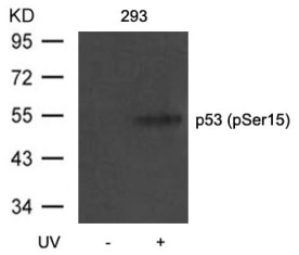 TP53 Antibody