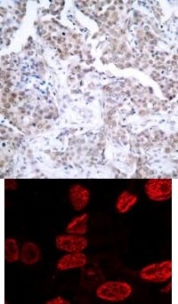 TP53 Antibody