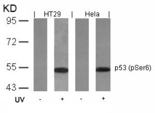 TP53 Antibody