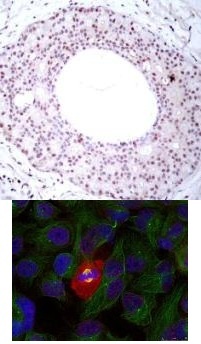 RELA Antibody