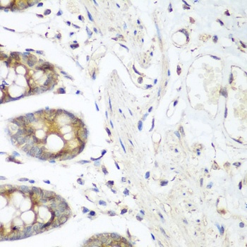 FLT4 Antibody