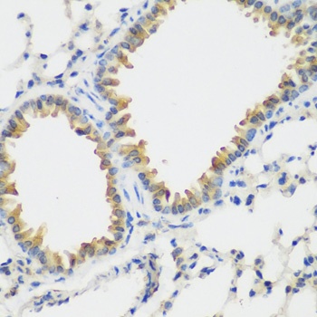 FLT4 Antibody
