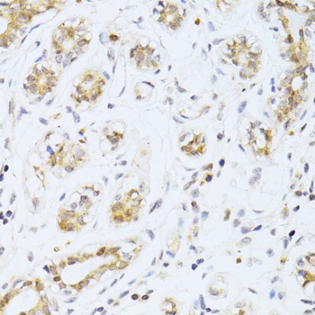 ETV1 Antibody