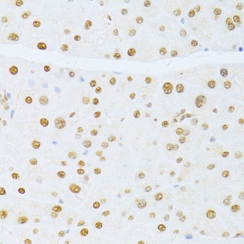 ETV1 Antibody