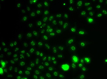 ETV1 Antibody