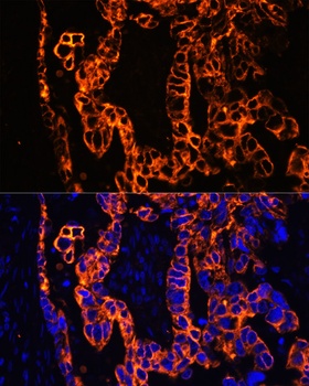 KRT7 Antibody