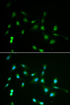 PIWIL4 Antibody