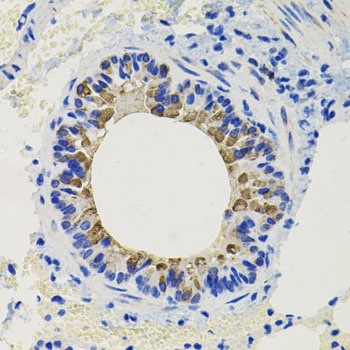 CALB2 Antibody