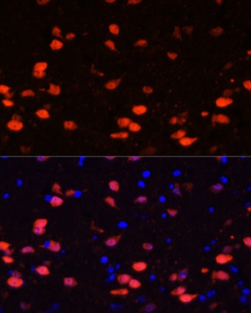 CALB2 Antibody