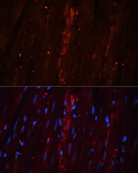 CORO1A Antibody