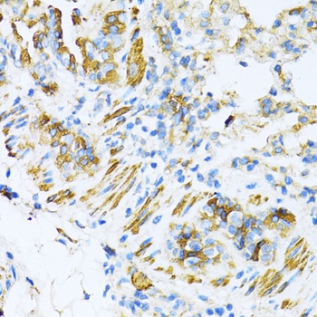 VAMP1 Antibody