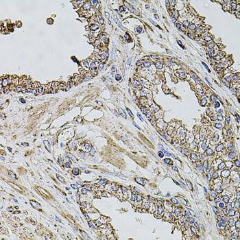 TMC1 Antibody