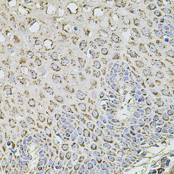 TMC1 Antibody