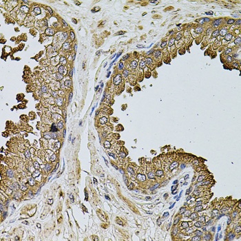 MTIF3 Antibody