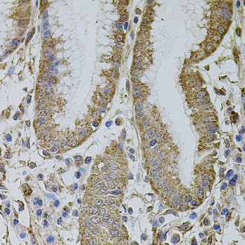 MTIF3 Antibody