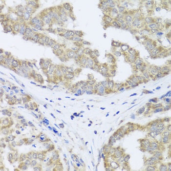 TIMM10B Antibody