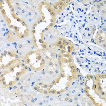 BCKDK Antibody