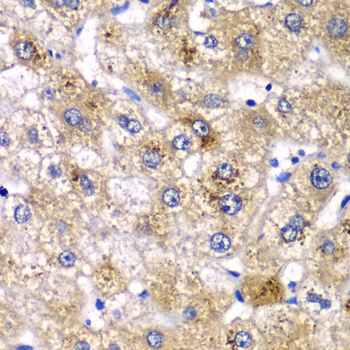 AMY2A Antibody