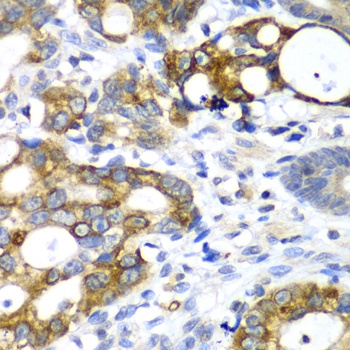 AMY2A Antibody