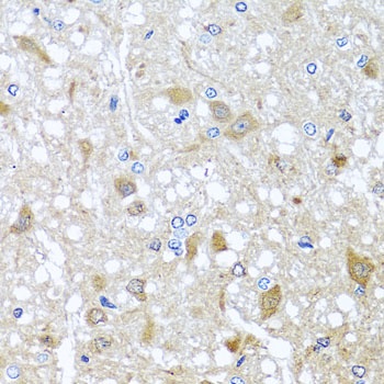 EFHC1 Antibody