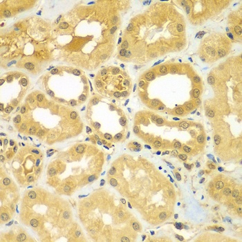 CALCOCO1 Antibody
