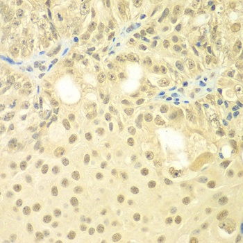 TBL1XR1 Antibody