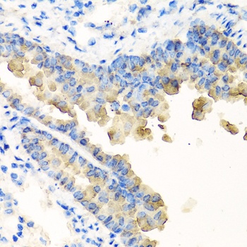 NYX Antibody