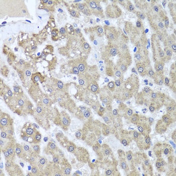 ALKBH4 Antibody