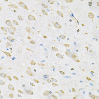 TRIM29 Antibody