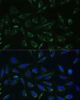HCCS Antibody