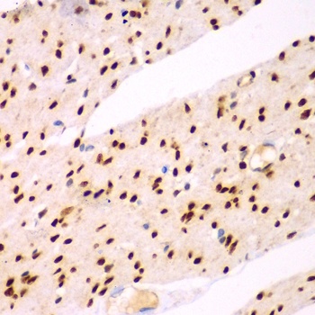 TEAD3 Antibody