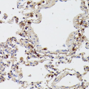 RIPK1 Antibody