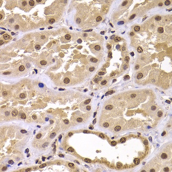 CSRP2BP Antibody