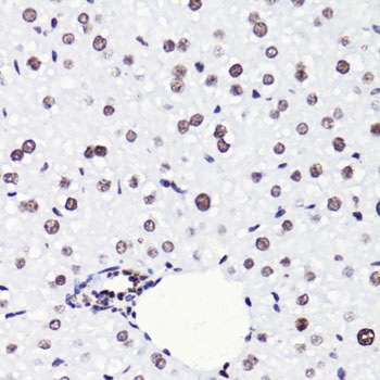 H4K8ac Antibody