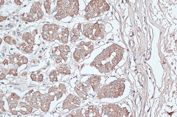 Acetyl-Histone H3-K18 pAb