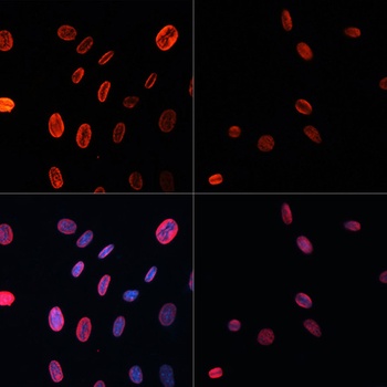 Acetyl-Histone H3-K18 pAb
