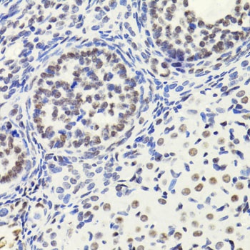 Acetyl-Histone H3-K18 pAb