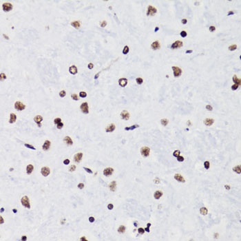 Acetyl-Histone H3-K18 pAb