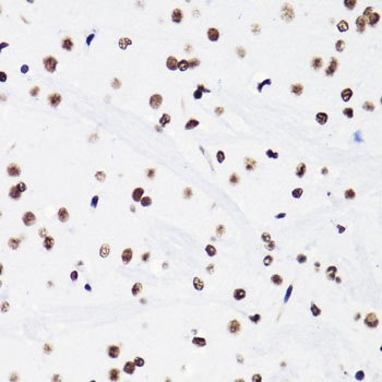 Acetyl-Histone H3-K18 pAb