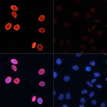 Acetyl-Histone H3-K56 pAb