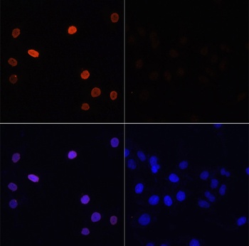 Acetyl-Histone H3-K14 pAb