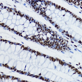 Acetyl-Histone H3-K27 pAb