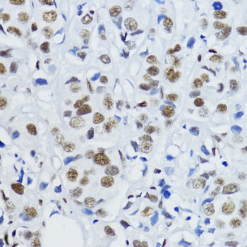 Acetyl-Histone H3-K27 pAb