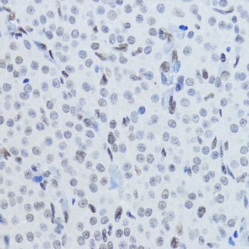 Acetyl-Histone H3-K27 pAb