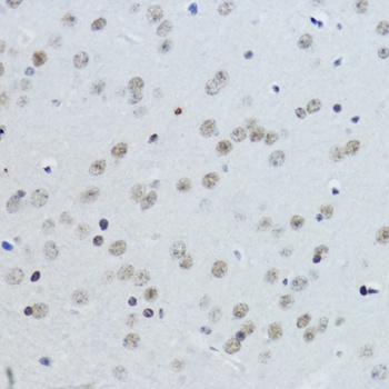 Acetyl-Histone H3-K27 pAb