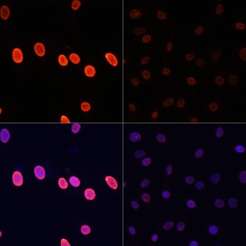 Acetyl-Histone H3-K27 pAb