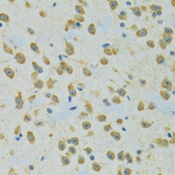 RPS7 Antibody